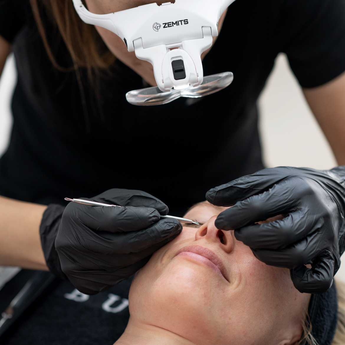 The Deep Pore Extraction Facial